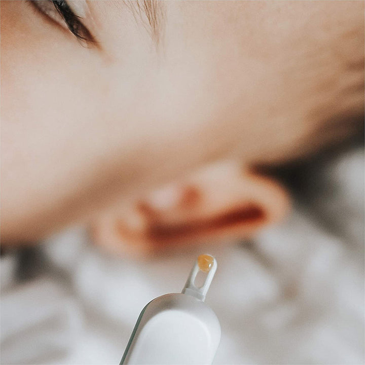 FridaBaby 3-In-1 Nose, Nail + Ear Picker Essential Tool For Babies